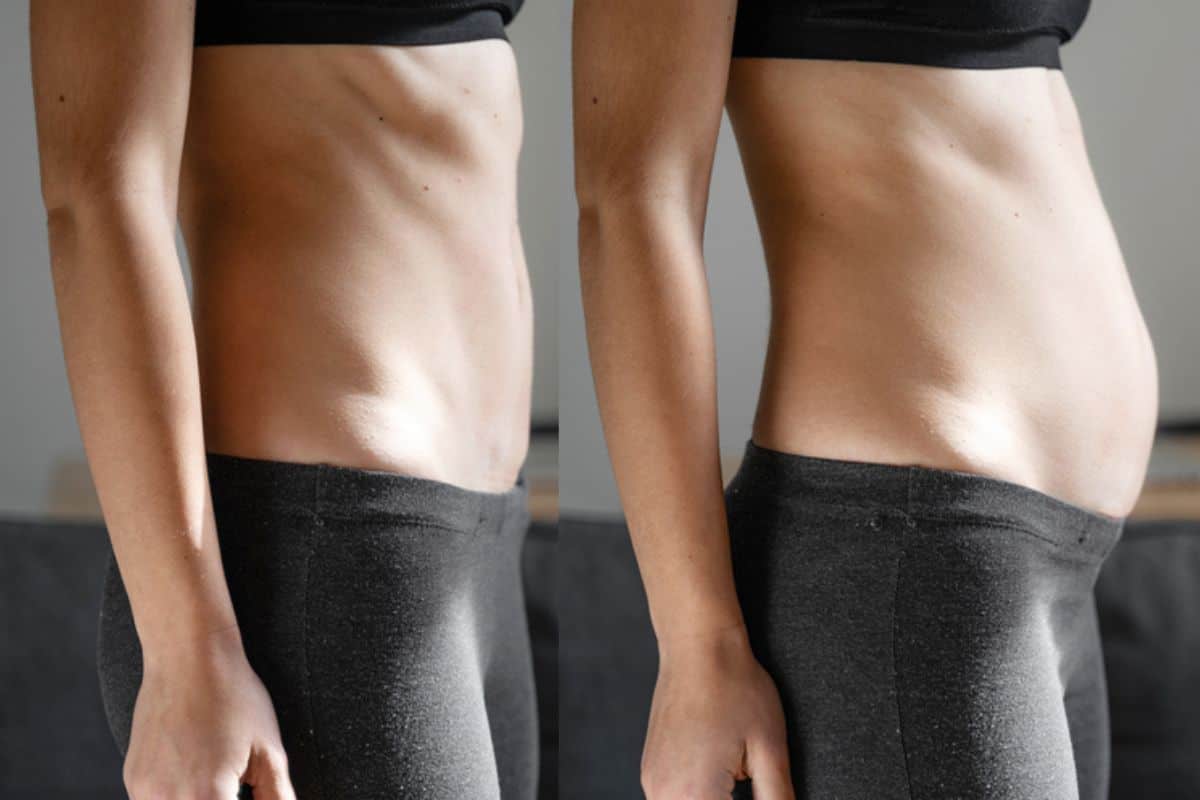 How long does diastasis recti take to improve King's Hill?