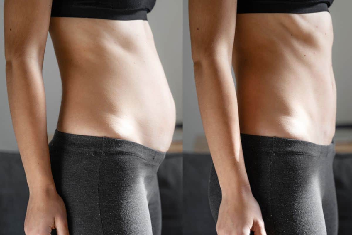 Post-Pregnancy: What Happens to Your Abdominal Muscles After Birth King's Hill